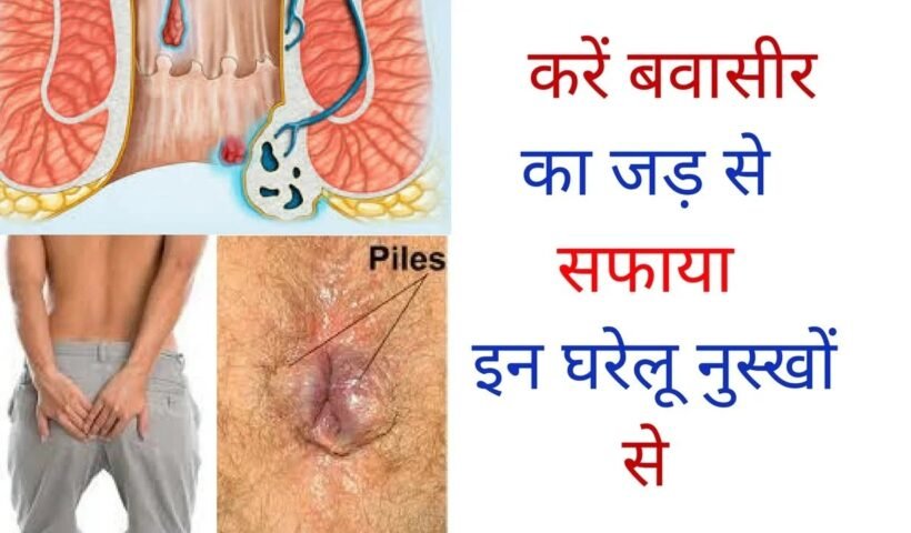 इन वजहों से होता है बवासीर येˈ है बचने के अचूक उपायˌ