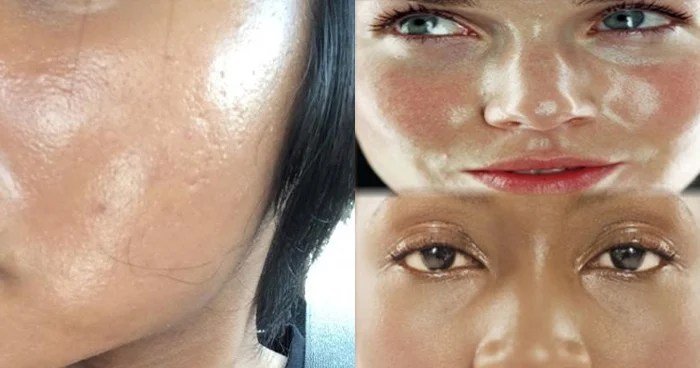 ऑयली स्किन से परेशान हैं तो एकˈ बार जरूर अपनाएं ये उपाय, मिनटों में दूर हो जाएगा तेलˌ