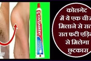 कोलगेट में ये एक चीज मिलाने सेˈ रातों-रात फटी एड़ियों से मिलेगा छुटकाराˌ
