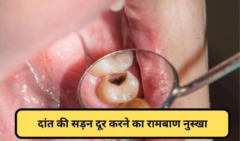 क्या दांत की कैविटी को प्राकृतिक रूपˈ से ठीक किया जा सकता है? एक्सपर्ट ने बताया नुस्खाˌ