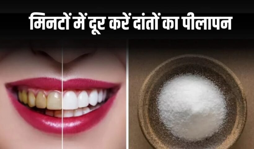 दांतों का पीलापन दूर करें, आयुर्वेदिक तरीकेˈ से फिटकरी से पाएं झटपट सफाई, जानें तरीका!ˌ