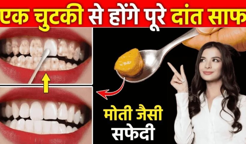 दांतों को सफेद और साफ करने काˈ आसान उपाय, फिटकरी से घर पर बनाएं मंजनˌ