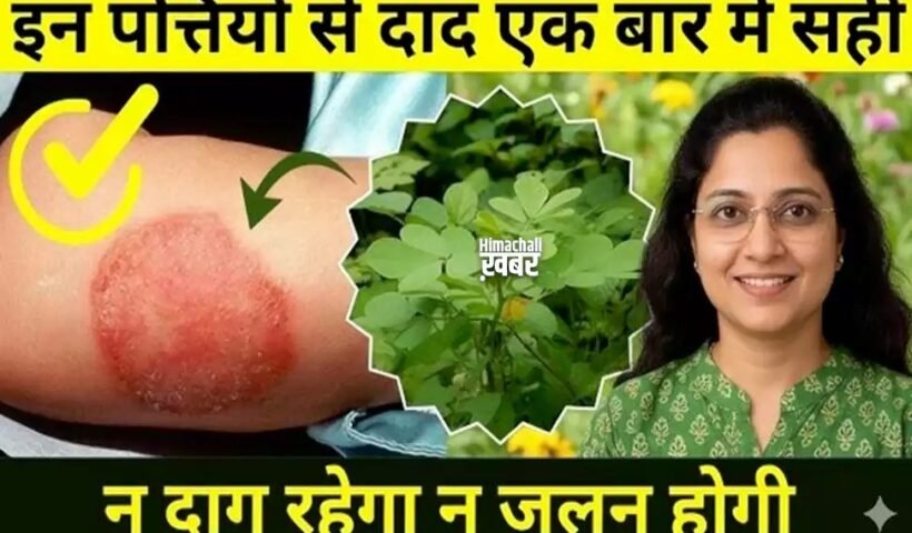 दाद को जड़ से मिटाने वाला शक्तिशालीˈ आयुर्वेदिक नुस्खा, विस्तार में जानें इसके बारे मेंˌ