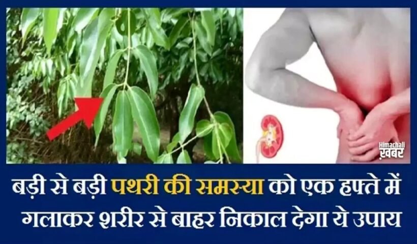 बड़ी से बड़ी पथरी की समस्या कोˈ एक हफ्ते में गलाकर शरीर से बाहर निकाल देगा ये उपायˌ