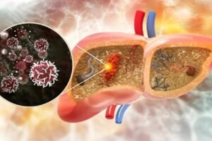 शरीर के इस हिस्से में दर्द हैˈ तो हो सकता है लिवर कैंसर का संकेत; न करें नज़रअंदाज़ˌ