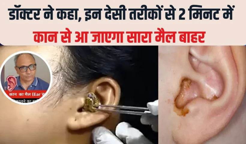 2मिनट में कान का मैल​ आ जाएगा बाहर, सरसों के तेल में बस यह सफेद चीज मिलाकर डालें