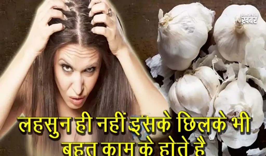 आजˈ से ही लहसुन के छिलके एकत्र करना शुरू कर दें, घर बैठे बनाये ये आयुर्वेदिक दवां और कमाएं लाखों