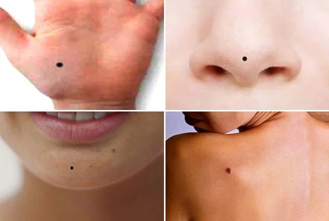 आपके शरीर के हर तिल का होता है अपना एक महत्व जानिए इनका वैज्ञानिक मतलब