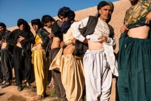 इसˈ गांव में ज्यादातर लोगों की गायब है एक-एक किडनी खाने की प्लेट से जुड़ी है वजह