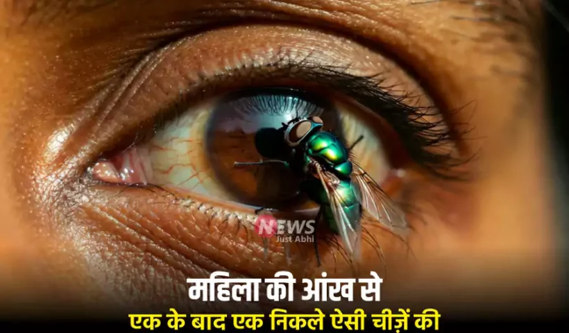 इसमहिला की आंख से एक​ के बाद एक निकले ऐसी चीज़ें की डॉक्टर भी रह गए दंग, आप भी ध्यान दें