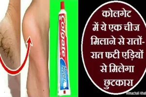 कोलगेटमें ये एक चीज मिलाने​ से रातों-रात फटी एड़ियों से मिलेगा छुटकारा