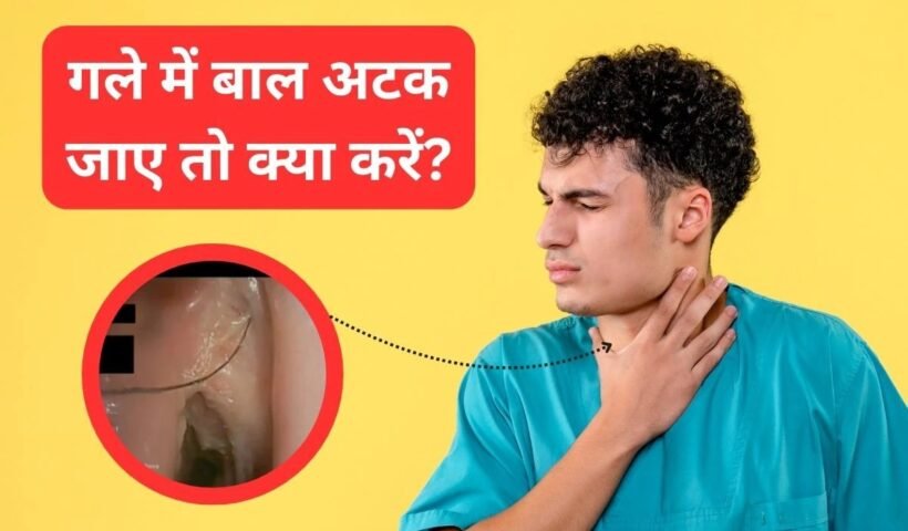 गलेˈ में बाल फंस जाए तो क्या करना चाहिए? डॉक्टर ने बताया घर पर 2 मिनट में कैसे करें गला साफ