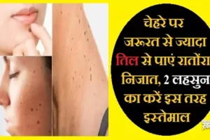चेहरेपर जरूरत से ज्यादा तिल​ से पाएं रातोंरात निजात, 2 लहसुन का करें इस तरह इस्तेमाल