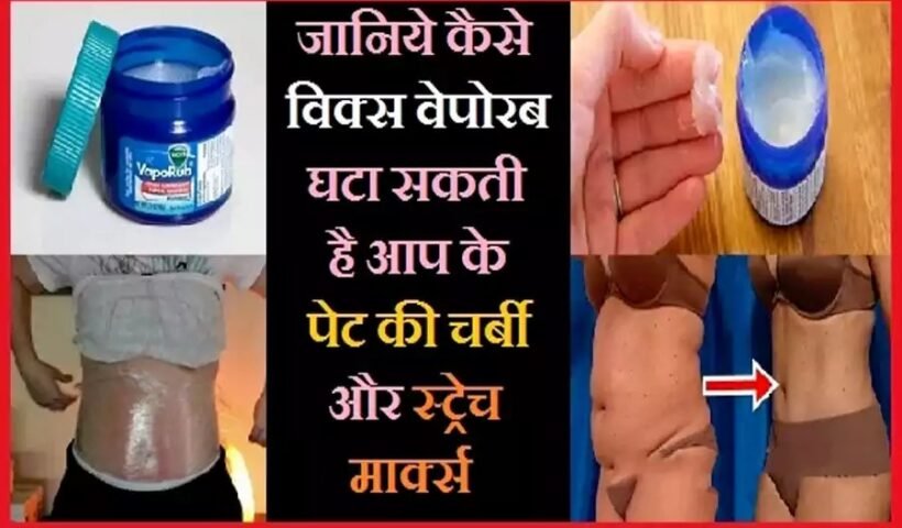 जानिये कैसे विक्स वेपोरब घटा सकती है आप के पेट की चर्बी और स्ट्रेच मार्क्स