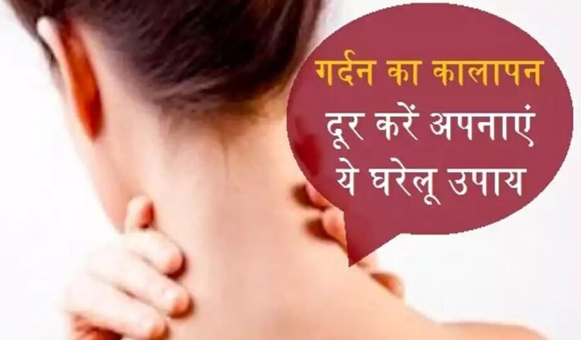 तवेˈ से भी काली गर्दन का कालापन दूर करेंगे ये चमत्कारी घरेलू उपाय, बस सही तरीका होना चाहिए पता