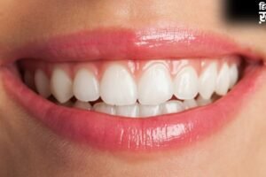 दांतों पर दिखने लगी है पीले रंग की परत, तो अपनाएं ये तरीका, चमक जाएंगे आपके दांत