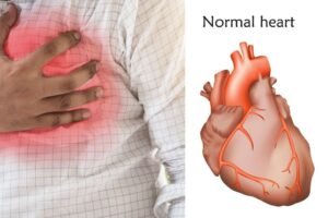 पैरोंकी ये मामूली दिक्कतें हार्ट​ फेलियर के शुरुआती लक्षण हो सकते हैं न करें नजरअंदाज