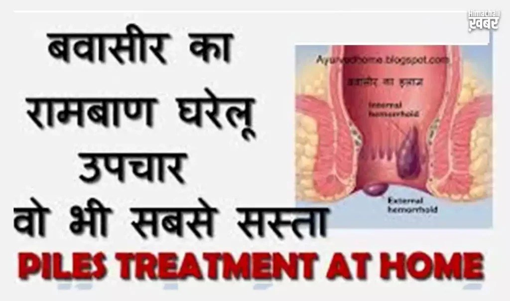 बवासीर के दर्द से तुरंत राहत पाने के लिए एक बार इस पोस्ट को ज़रूर पढ़ें पोस्ट शेयर करना ना भूले