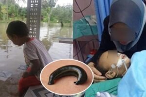 बाढ़के पानी में खेलना मासूम​ को पड़ा महंगा होने लगी उल्टियाँ कोमा में जा पहुंचा