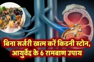 बिनासर्जरी घुल जाएंगे किडनी स्टोन!​ जानिए आयुर्वेद डॉक्टर के 6 रामबाण उपाय
