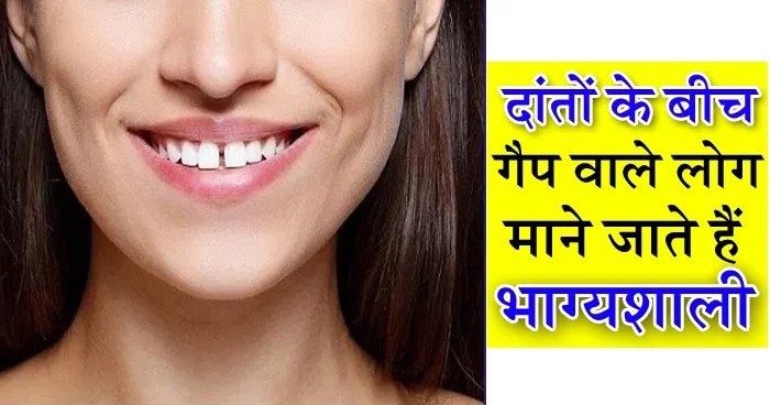 भाग्यशाली माने जाते हैं दांतों के बीच गैप वाले लोग ये 8 खूबियां उन्हें बनाती हैं सब से ख़ास