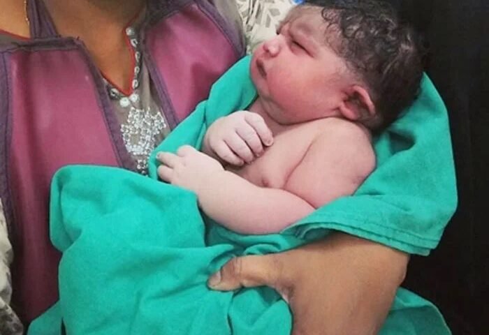 महिला ने दिया 5.2 KG के बच्चे को जन्म, देखकर डॉक्टर्स भी बोले- पहले नहीं देखा ऐसा बच्चा