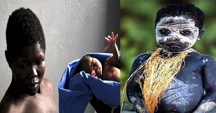 यहाँˈ बच्चा गौरा पैदा हो तो मिलती हैं दर्दनाक सजा काली संतान के लिए महिलाएं पीती हैं ये चीज