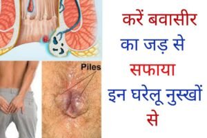 ​​इन वजहों से होता है बवासीर ये है बचने के अचूक उपाय​​​​​