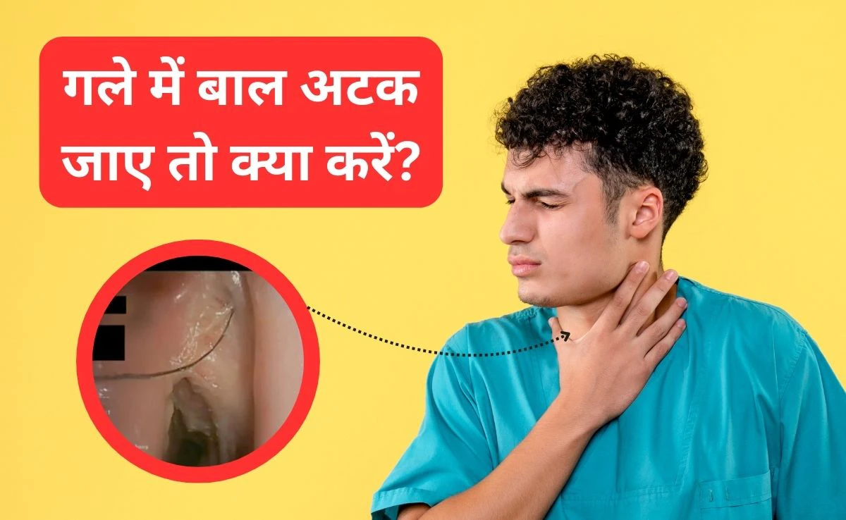​​गले में बाल फंस जाए तो क्या करना चाहिए? डॉक्टर ने बताया घर पर 2 मिनट में कैसे करें गला साफ​​​​​