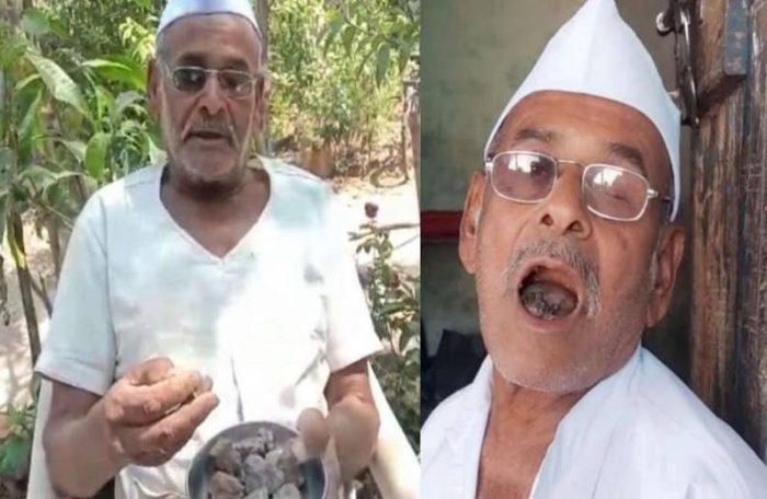 ​​ये हैं 80 साल के पत्थर वाले बाबा, एक दिन में चट कर जाते हैं 250 ग्राम पत्थर​​​​​